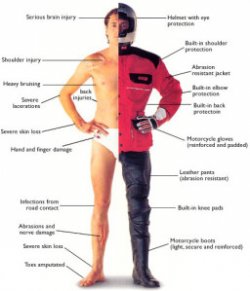 Motorcycle Injury Areas